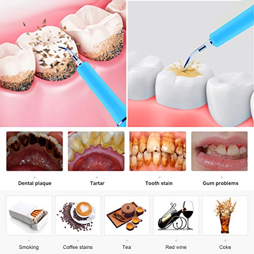 Dişler için Plak Sökücü, Qmix Ultrasonik Diş Temizleyici Elektrikli Diş Taşı Kazıyıcı Tartar Diş Temizleme Kiti, 5 Ayarlanabilir
