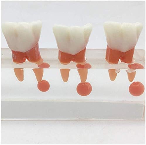 Eğitim Modeli Diş Ağız Boşluğu Hamuru Hastalığı Tedavi Modeli Diş Anatomik Modeli Diş Diş Modeli Gösterisi Diş Miyelopati Tedavi